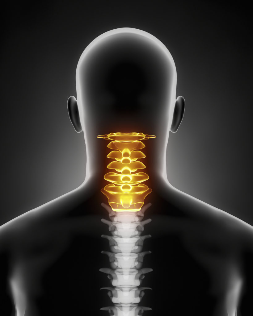 What’s Involved in Anterior Cervical Discectomy and Fusion?