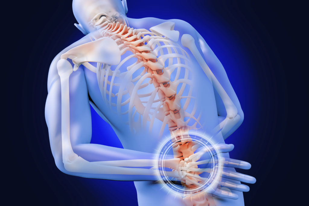 Lumbar Fusion: What You Need To Know About This Back Surgery