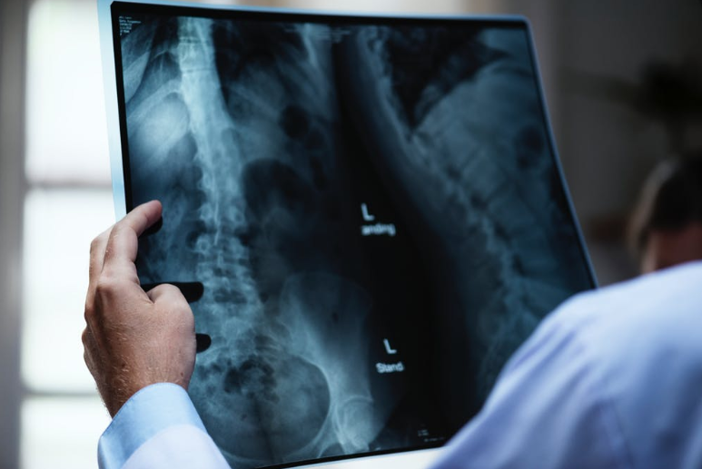Types of Spine Surgery: Discectomy, Spinal Fusion, Vertobroplasty, Kyphoplasty